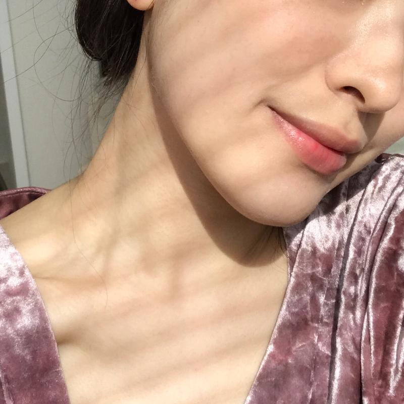 20代のニキビは10代のものと違う