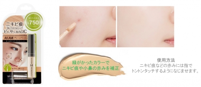 ニキビを隠す!