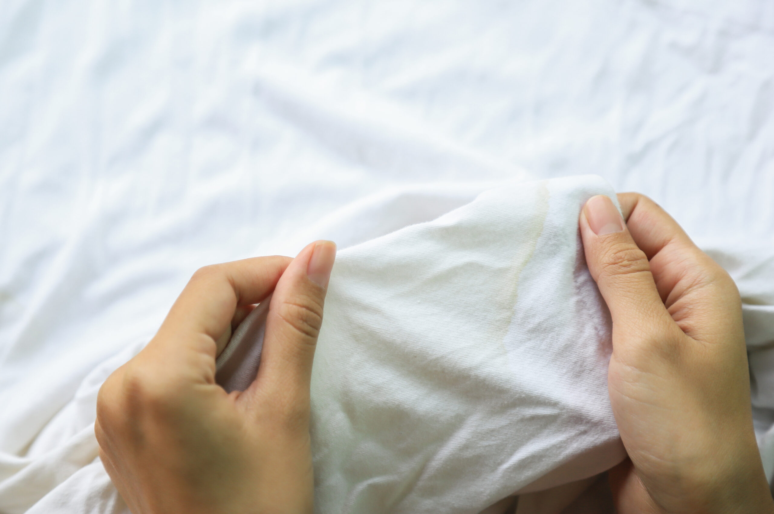 洗濯では落としきれず、蓄積した汚れが酸化してできる