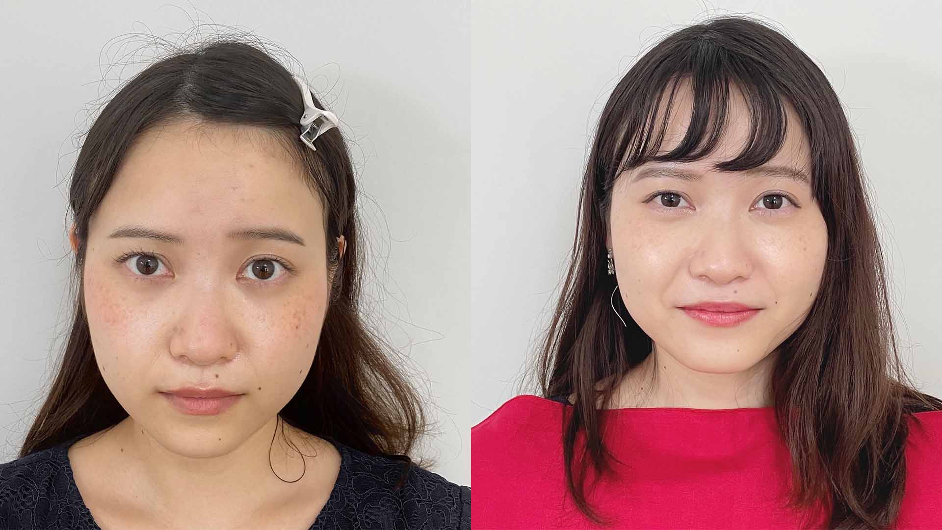 beforeafter